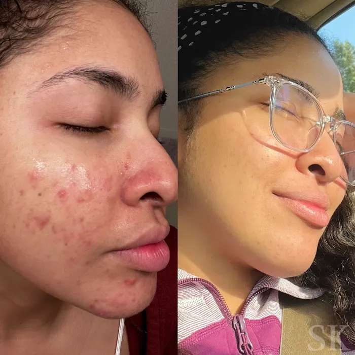 Skin Klarity Picture 3