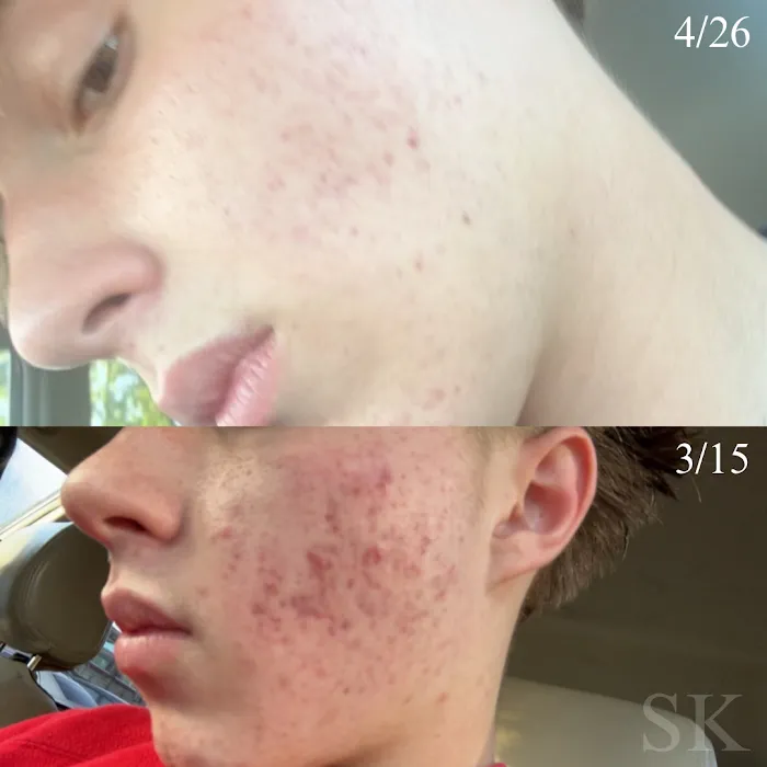 Skin Klarity Picture 10