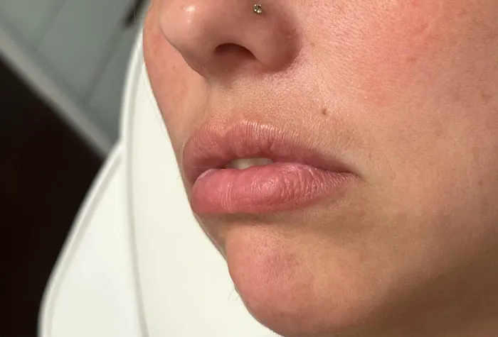 Dermaesthetics Picture 4