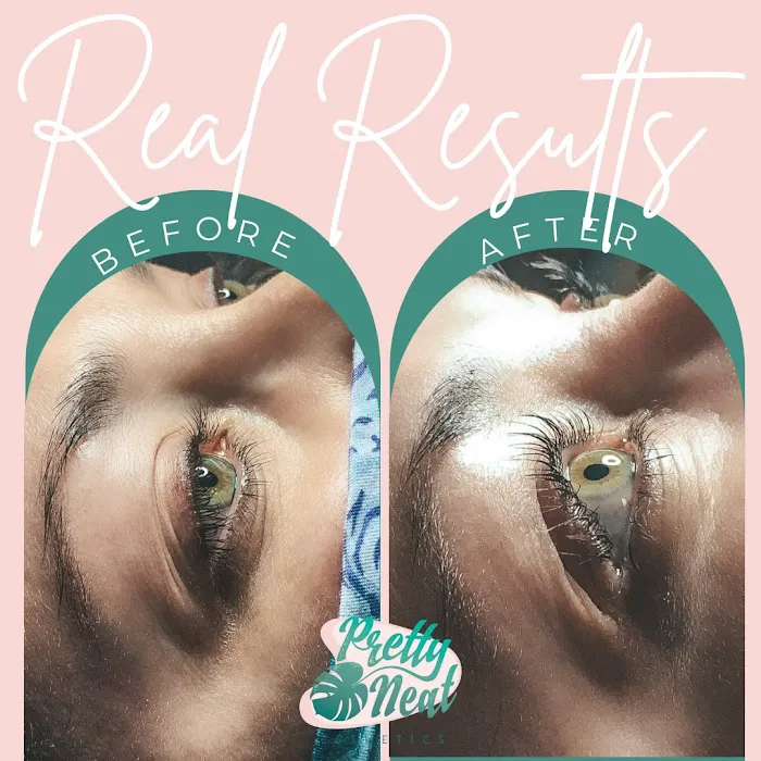 Pretty Neat Esthetics Picture 3