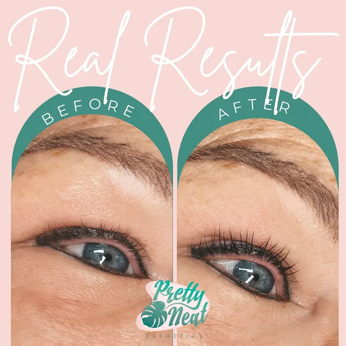 Pretty Neat Esthetics Picture 2