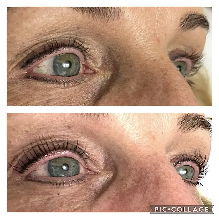 Primal Glow Aesthetics Picture 5