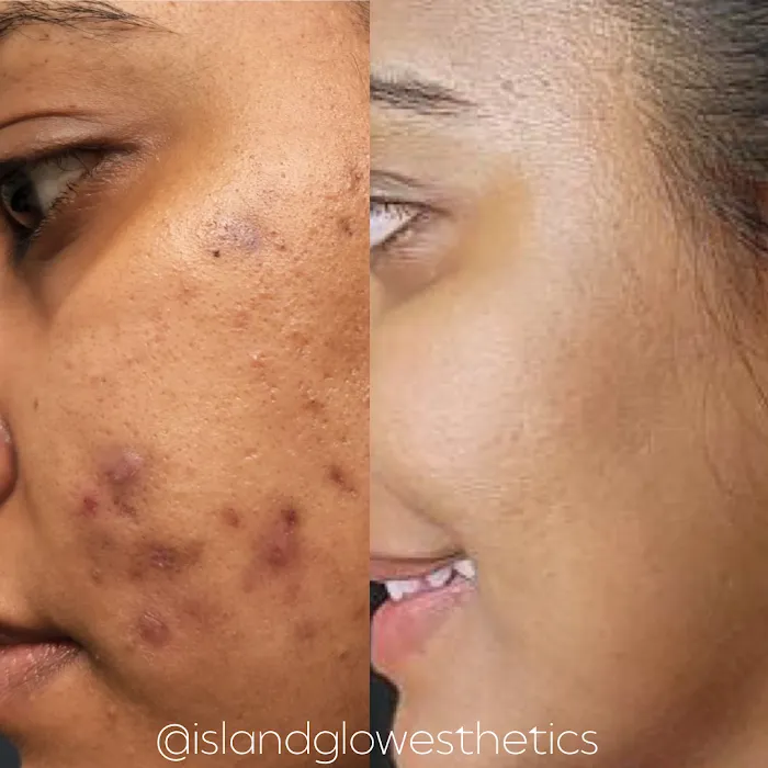 Island Glow Esthetics Picture 7