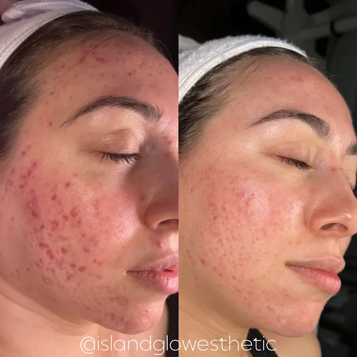Island Glow Esthetics Picture 5
