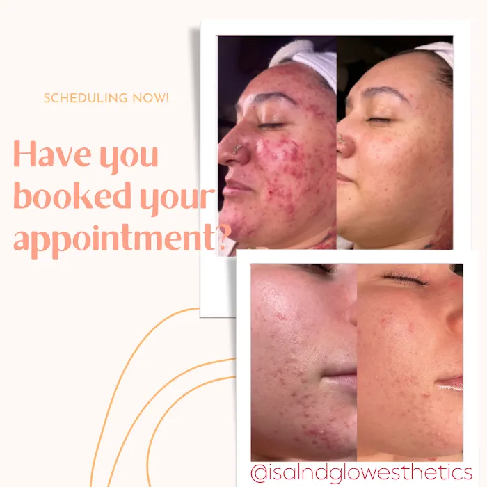 Island Glow Esthetics Picture 4