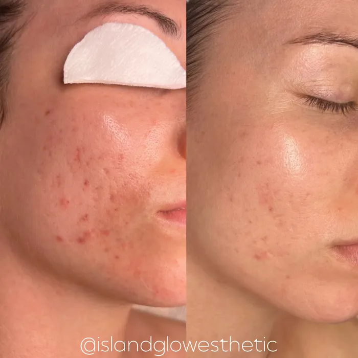 Island Glow Esthetics Picture 6