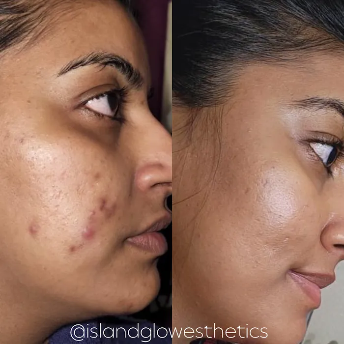 Island Glow Esthetics Picture 8