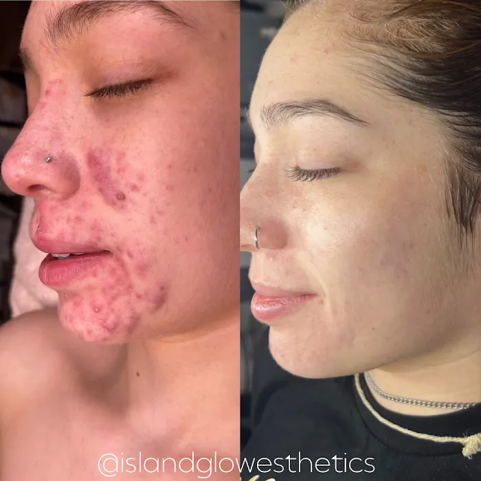 Island Glow Esthetics Picture 9