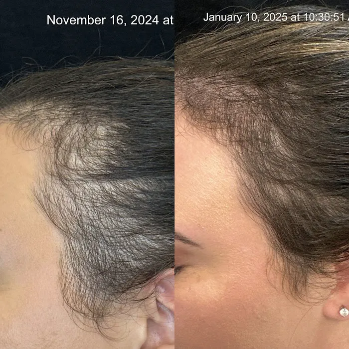 Studio H Skin Care - Hydrafacial Picture 3