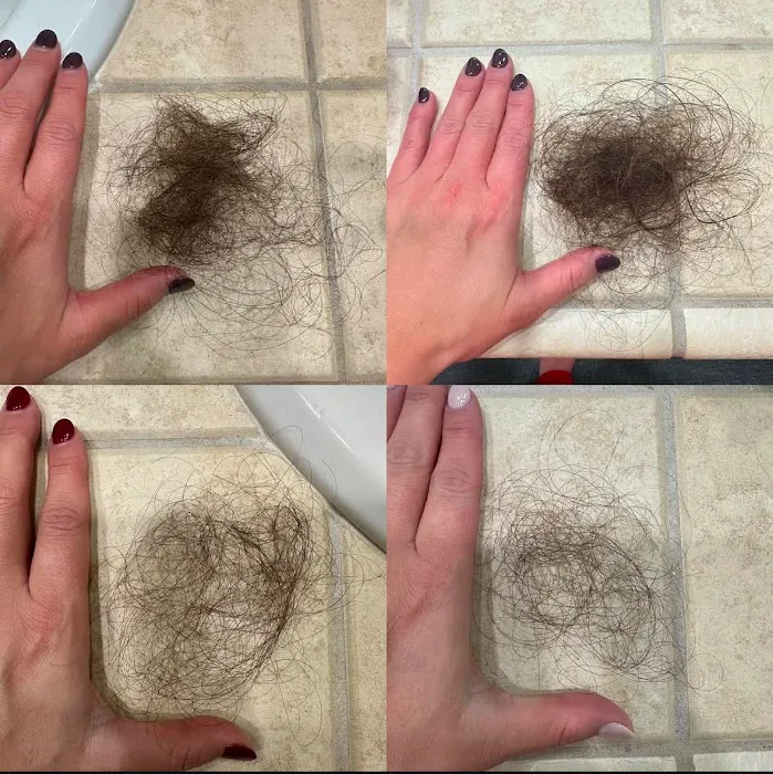 Studio H Skin Care - Hydrafacial Picture 2