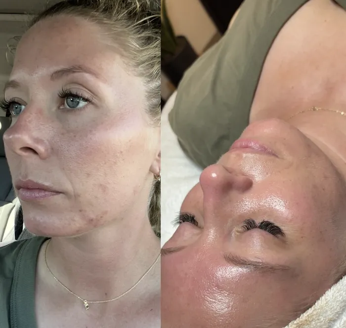 The Skin Suite Picture 7