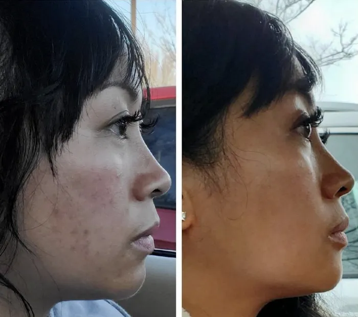 The Skin Suite Picture 8