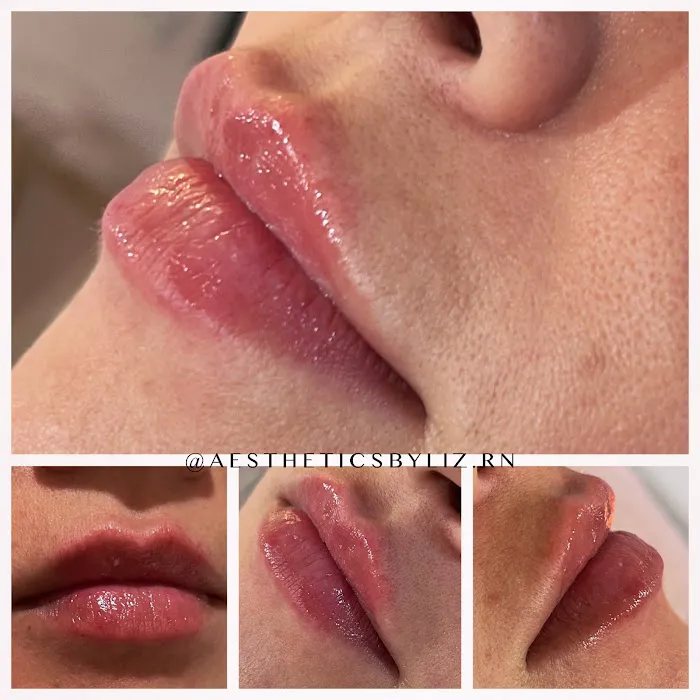 Liz K. Aesthetics Picture 6