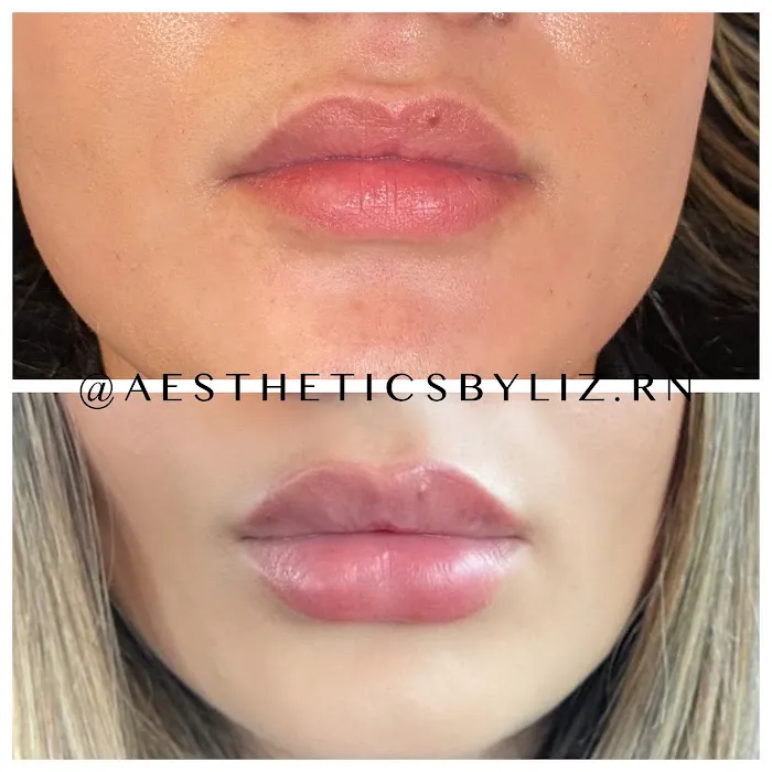 Liz K. Aesthetics Picture 8