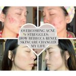 Rebecca Renee Skincare Holistic Acne Clinic