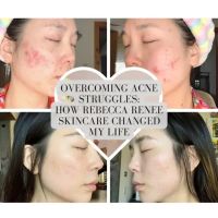 Rebecca Renee Skincare Holistic Acne Clinic ico
