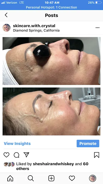 Pure Skincare With Crystal Picture 4