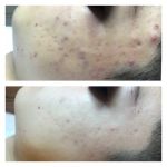 Pure Skincare With Crystal