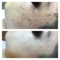 Pure Skincare With Crystal ico