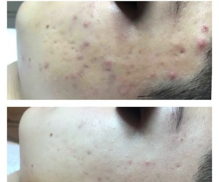 Pure Skincare With Crystal