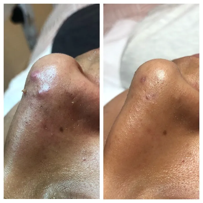 Pure Skincare With Crystal Picture 7