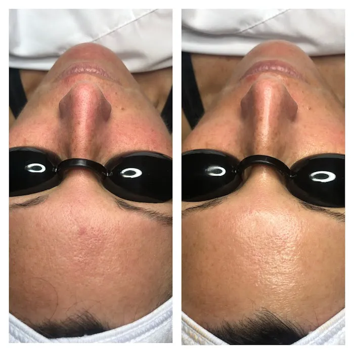 Pure Skincare With Crystal Picture 2