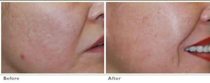 Berman Skin Institute | Medical & Cosmetic Dermatology Picture 5