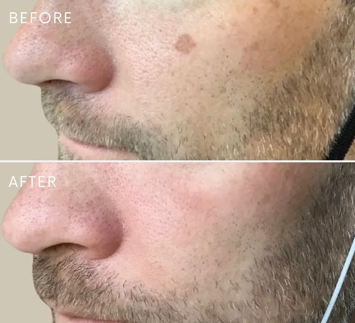 Berman Skin Institute | Medical & Cosmetic Dermatology Picture 8