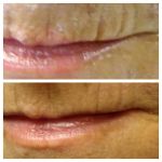 SpectacularSkin, Inc.