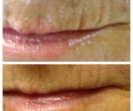 SpectacularSkin, Inc.