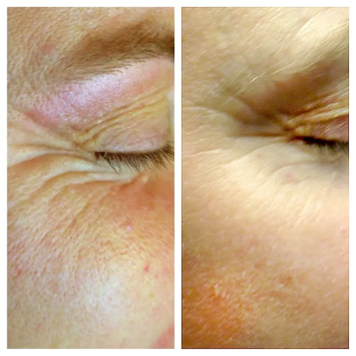 SpectacularSkin, Inc. Picture 3