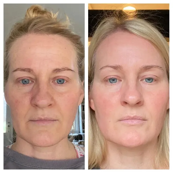 Aisha Skin Beauty Picture 6