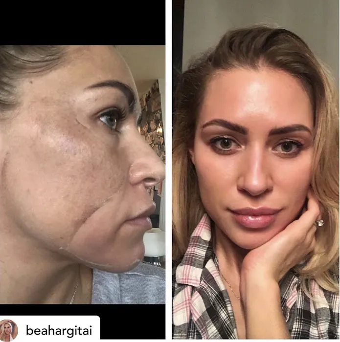 Aisha Skin Beauty Picture 3