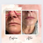 Forever Gorgeous Aesthetics