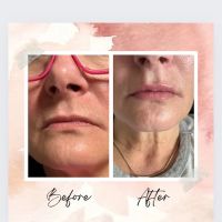 Forever Gorgeous Aesthetics ico