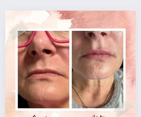 Forever Gorgeous Aesthetics