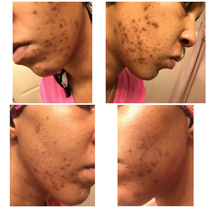 Shawishi Skincare Collection Picture 9