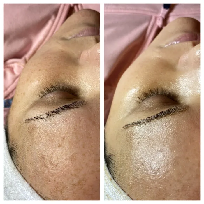 Chloe Carole Aesthetics Picture 2