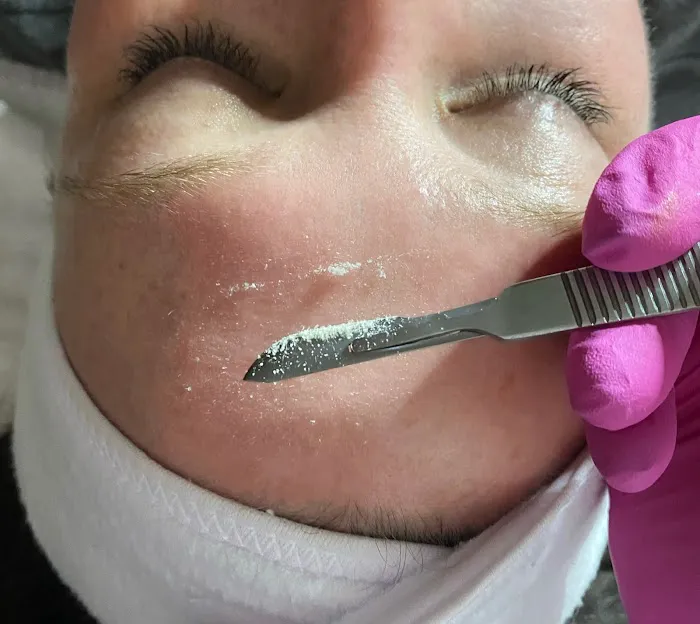 Chloe Carole Aesthetics Picture 4