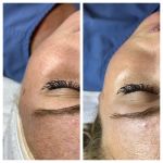 Chloe Carole Aesthetics