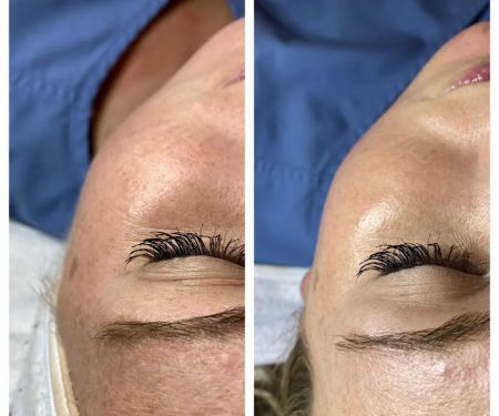 Chloe Carole Aesthetics