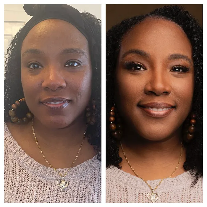 Chloe Carole Aesthetics Picture 7