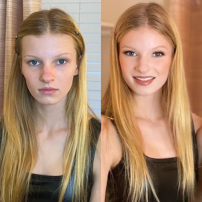 Chloe Carole Aesthetics Picture 10