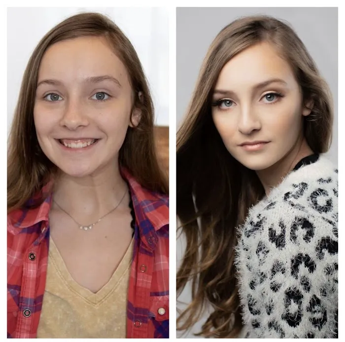 Chloe Carole Aesthetics Picture 8