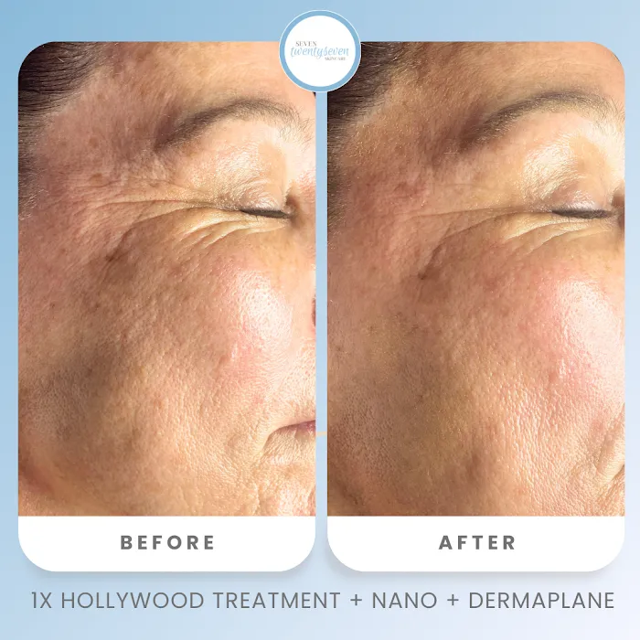 seven twentyseven skincare Picture 5