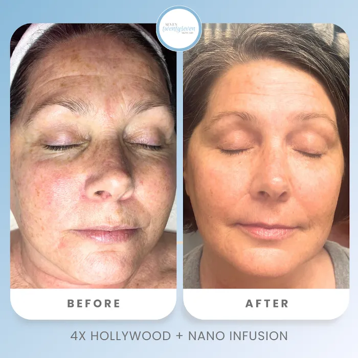 seven twentyseven skincare Picture 9