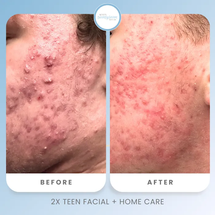 seven twentyseven skincare Picture 8