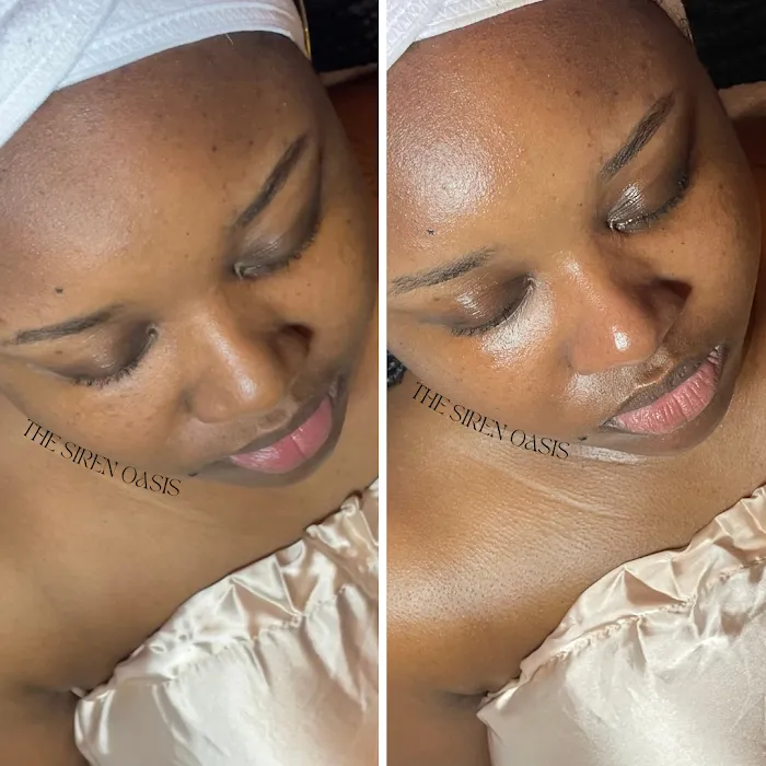 The Siren Oasis Aesthetics Picture 2