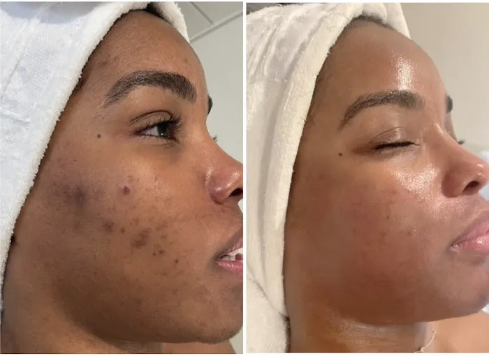 Maraki Skin Picture 3