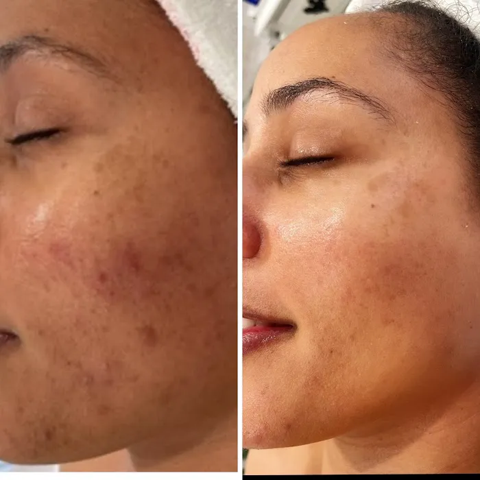 Maraki Skin Picture 5